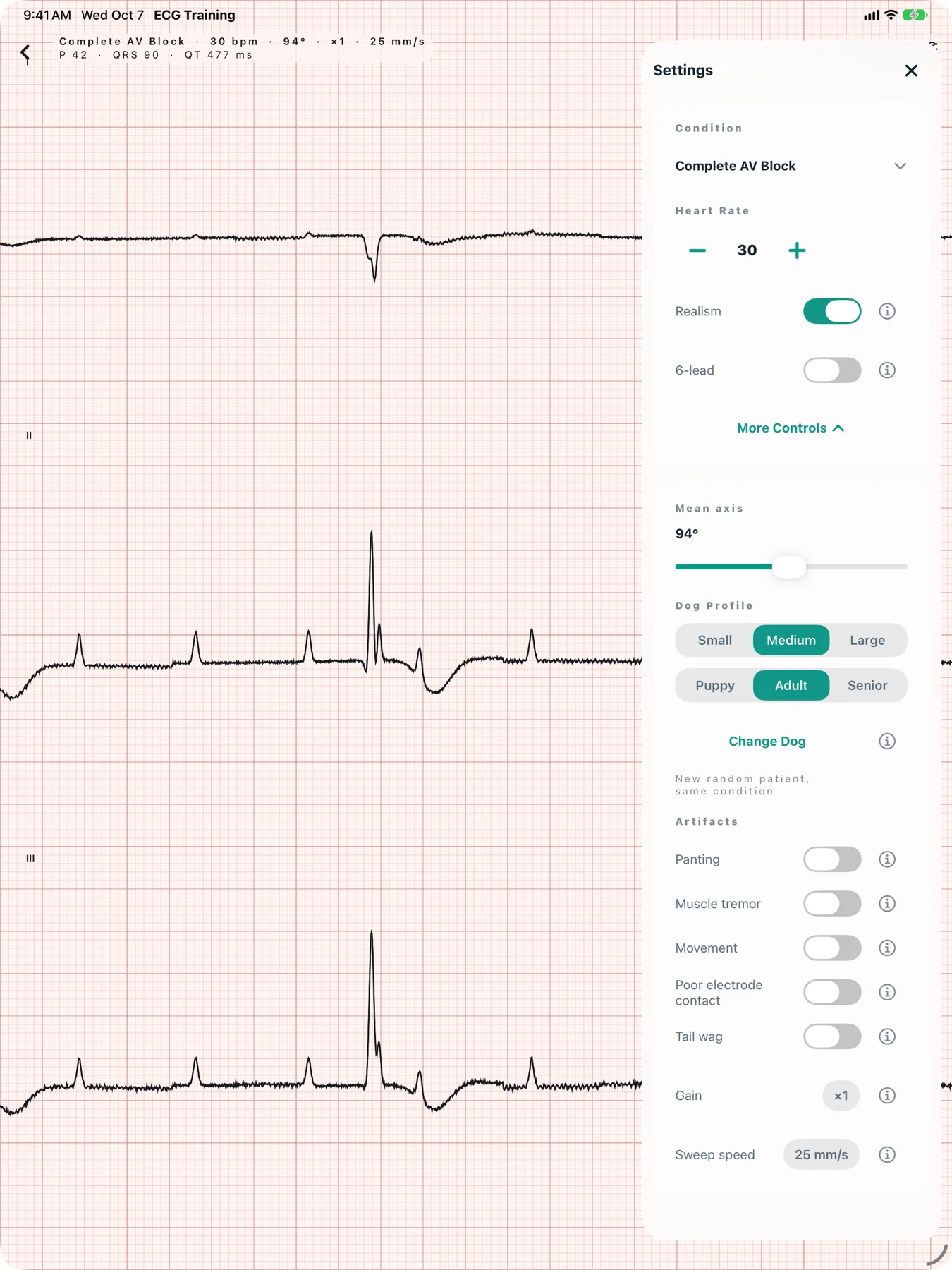 The simulator on an iPad showing complete AV block at 30 bpm with the settings panel open: condition, heart rate, realism, 6-lead, mean axis, dog profile, change dog, five artifacts, gain and sweep speed.